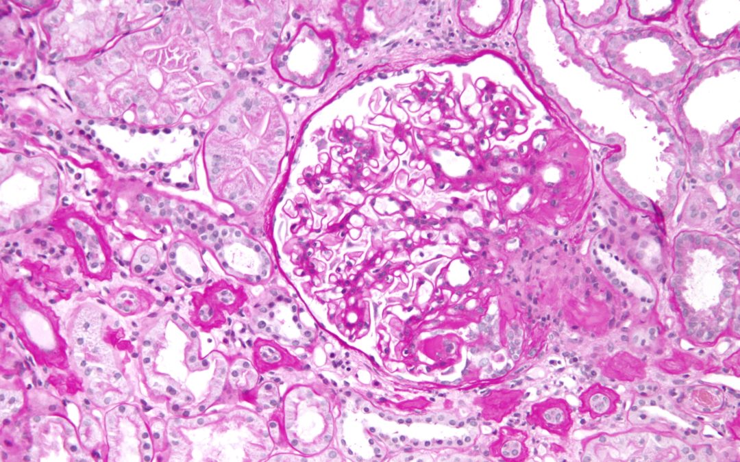 nephrology board review cases