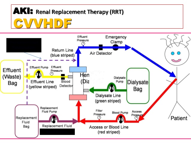 CRRT DOSE PRESCRIPTION – 36 TH INTERNATIONAL CRRT/AKI COURSE