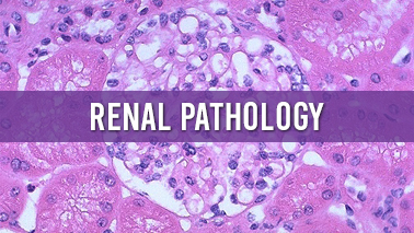 Basic Principles of Renal Pathology